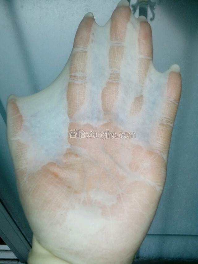 用手慢慢的撑出手套膜。