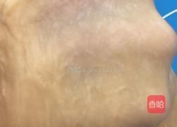 培根香葱手撕包的做法图解3